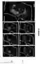 Fig. 19 - Methods of multiplexing DNA sensors and localizing DNA sensor