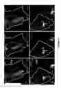 Fig. 22 - Methods of multiplexing DNA sensors and localizing DNA sensor