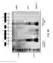 Fig. 12 - Methods for amplifying nucleic acids on substrates