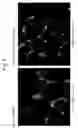 Fig. 06 - Skin activation by acceleration of PDGF-BB activity