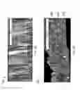 Fig. 05 - Hard aluminum films formed using high current density plating