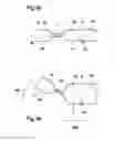 Fig. 08 - TEXTILE LEVER DEVICE