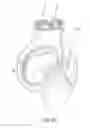 Fig. 06 - Primed jet toilet