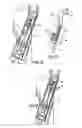 Fig. 05 - Bowden cable