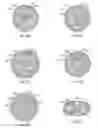 Fig. 06 - ESP System Having Carbon Nanotube Components