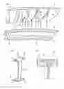 Fig. 04 - Guide vane assembly vane box of an axial turbine engine compressor