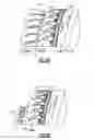 Fig. 05 - Gas turbine engine stator vane assembly with split shroud