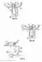 Fig. 07 - Multi-stage turbocharger system