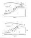 Fig. 03 - Turbine case cooling system