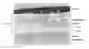 Fig. 01 - Wear-resistant chain pin