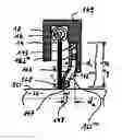 Fig. 01 - Brush seal