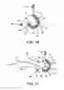 Fig. 13 - Cable suspension clamp
