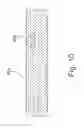 Fig. 11 - Unbonded flexible pipe