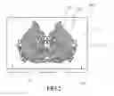 Fig. 03 - ARTISTIC LIGHTING MODULE AND METHOD FOR MANUFACTURING THE SAME
