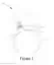Fig. 02 - Hair Band Device Having Function of Illumination