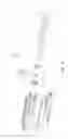 Fig. 08 - Weapon Barrel Having Integrated Suppressor