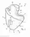 Fig. 02 - Universal gun holster