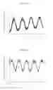 Fig. 05 - OPTICAL FIBER VIBRATION SENSOR AND METHOD OF MEASURING VIBRATION USING THE SAME