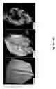 Fig. 09 - Simultaneous dehydration and staining of tissue for deep imaging