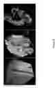 Fig. 09 - Novel Methods of Tissue Processing and Imaging
