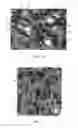 Fig. 04 - Biologic fluid sample analysis cartridge with non-reflective beads