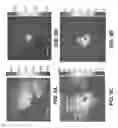 Fig. 07 - Interferometric focusing of guide-stars for direct wavefront sensing