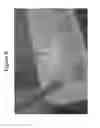 Fig. 10 - Time-resolved laser-induced fluorescence spectroscopy systems and uses thereof