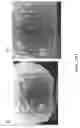Fig. 37 - Aptamers and uses thereof