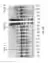 Fig. 62 - Aptamers and uses thereof