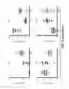 Fig. 10 - METHODS AND COMPOSITIONS FOR DIAGNOSING PREECLAMPSIA