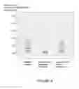 Fig. 05 - METHOD FOR PREDICTING THERAPY EFFICACY USING NUCLEOSOME STRUCTURE BIOMARKERS