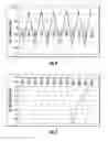 Fig. 07 - Systems and methods for an open wire scan