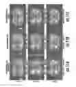 Fig. 09 - MRI with repeated K-T-sub-sampling and artifact minimization allowing for free breathing abdominal MRI