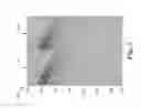 Fig. 08 - Interference attenuation of a residual portion of seismic data