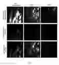 Fig. 06 - High frame-rate multichannel beam-scanning microscopy