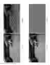 Fig. 08 - High frame-rate multichannel beam-scanning microscopy