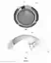 Fig. 02 - Ophthalmic devices with stabilization features