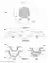 Fig. 04 - Ophthalmic devices with stabilization features