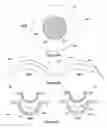 Fig. 05 - Ophthalmic devices with stabilization features