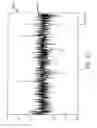 Fig. 14 - Techniques for locally improving signal to noise in a capacitive touch sensor