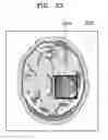 Fig. 29 - Medical image providing apparatus and medical image processing method of the same