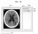 Fig. 32 - Medical image providing apparatus and medical image processing method of the same
