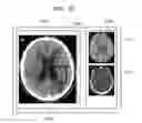 Fig. 33 - Medical image providing apparatus and medical image processing method of the same