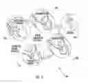 Fig. 03 - Computational flow dynamics based method for estimating thromboembolic risk in patients with myocardial infarction