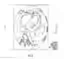 Fig. 04 - Computational flow dynamics based method for estimating thromboembolic risk in patients with myocardial infarction