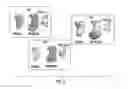 Fig. 09 - Computational flow dynamics based method for estimating thromboembolic risk in patients with myocardial infarction