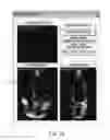 Fig. 05 - Evaluation system or determination of cardiovascular function parameters