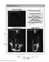 Fig. 06 - Evaluation system or determination of cardiovascular function parameters