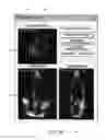 Fig. 07 - Evaluation system or determination of cardiovascular function parameters