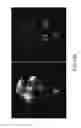 Fig. 16 - Evaluation system or determination of cardiovascular function parameters